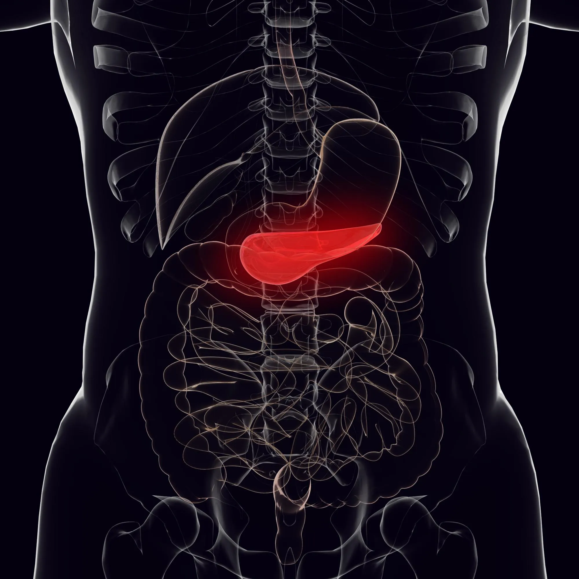 Ilustración médica de pancreatitis