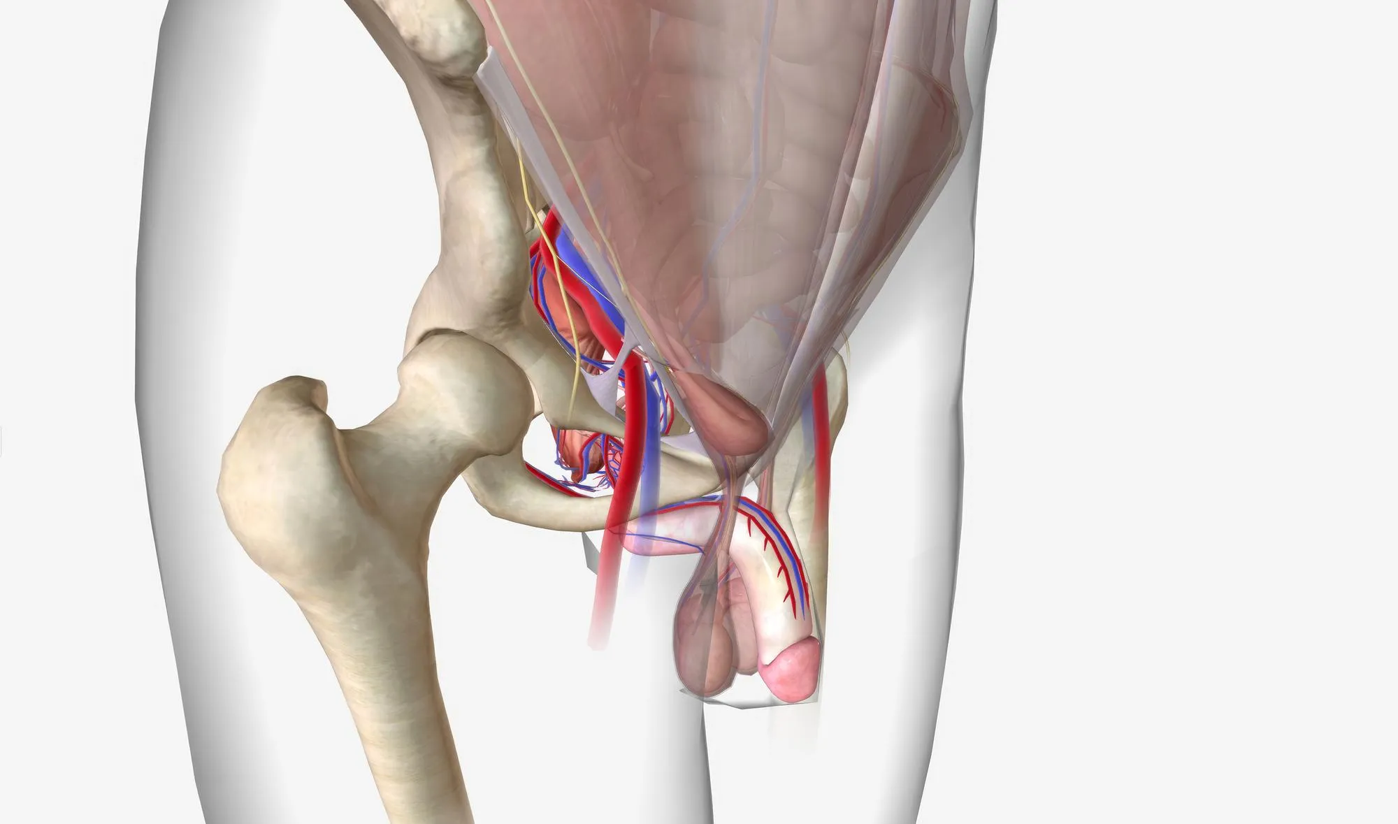 Cirugía tradicional de hernia inguinal